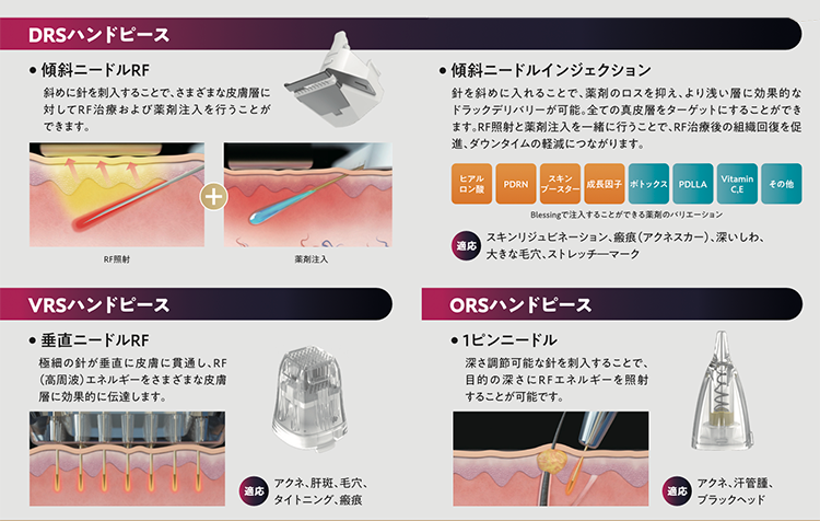 DRSハンドピース、VRSハンドピース、ORSハンドピースの3種類があります。