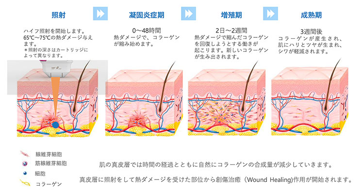 創傷治癒の過程