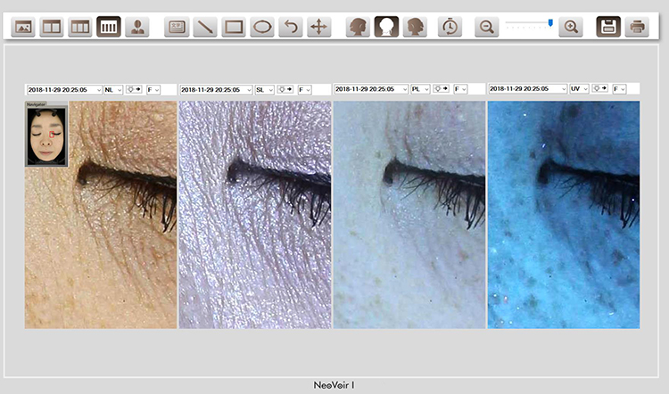 NeoVoir Ⅰ（肌診断機）説明その6