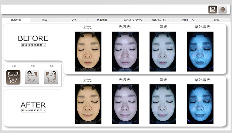 NeoVoir Ⅰ（肌診断機）説明その10