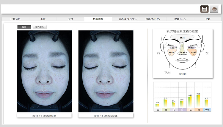 NeoVoir Ⅰ（肌診断機）説明その11