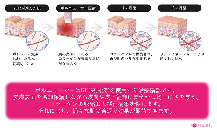 治療メカニズム